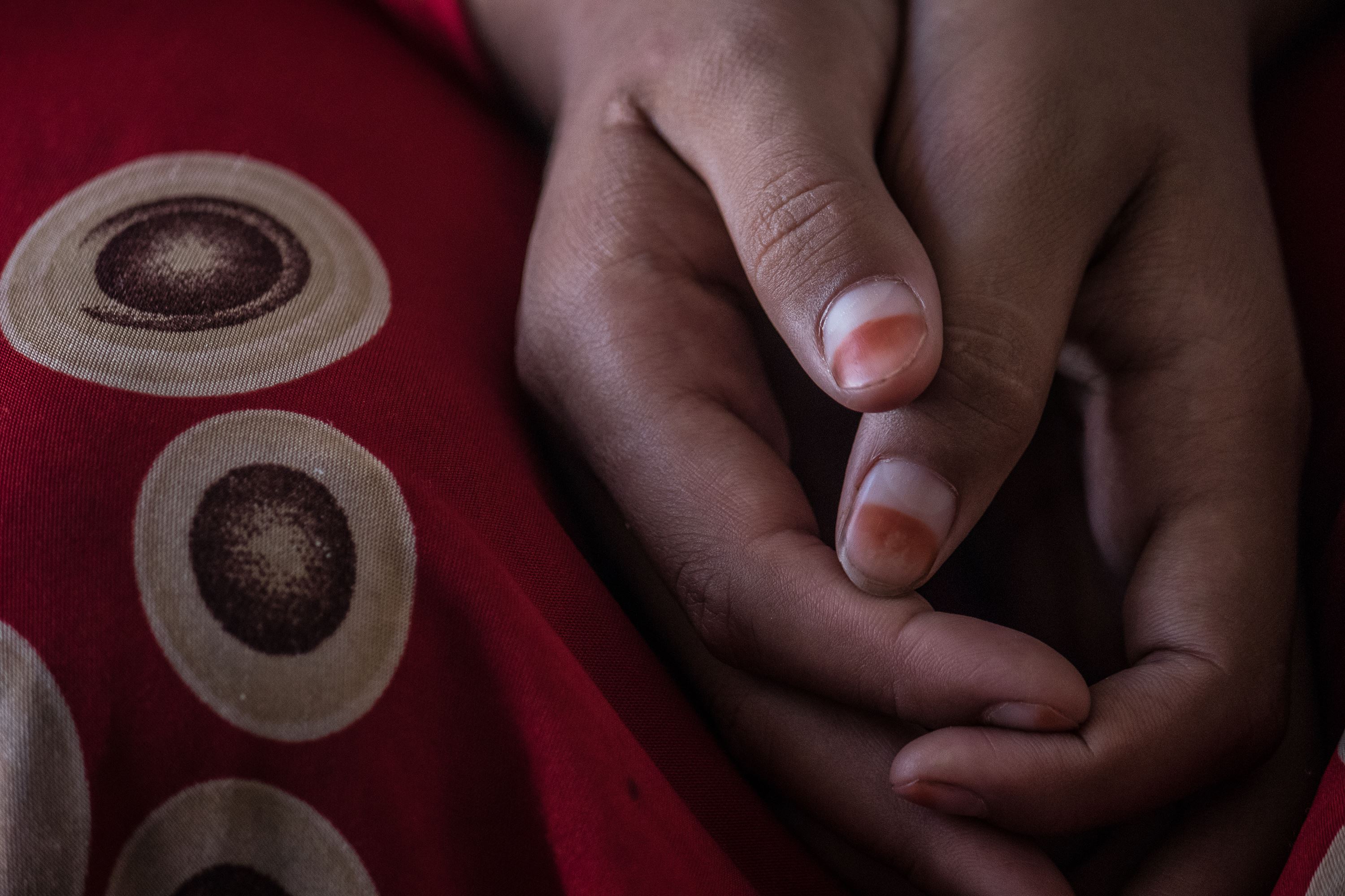A close up of a girls hands with henna painted on her nails and traditional material in the background