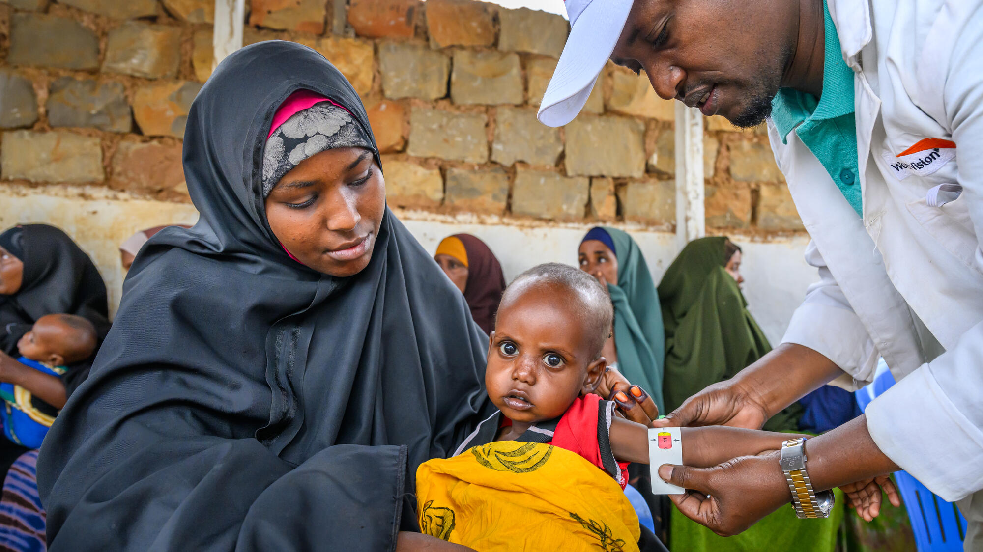 A World Vision health worker in Somalia measures the arm of a malnourished child